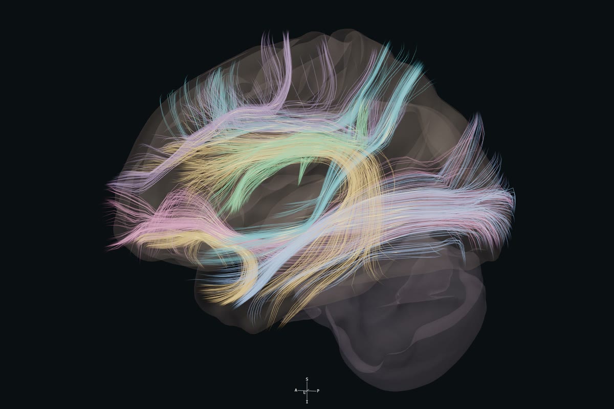 Association pathways revealed as the cortex fades, left hemisphere of the reference brain.