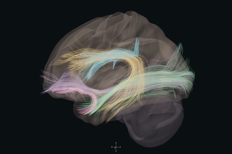 Left hemisphere reference view of dorsal and ventral language pathways.