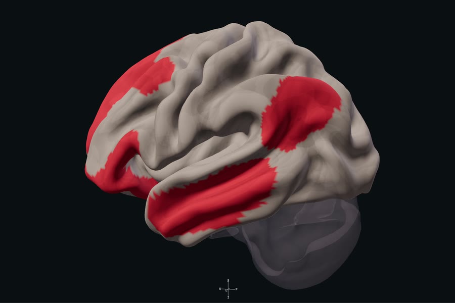 Default mode network highlighted on the reference cortex.