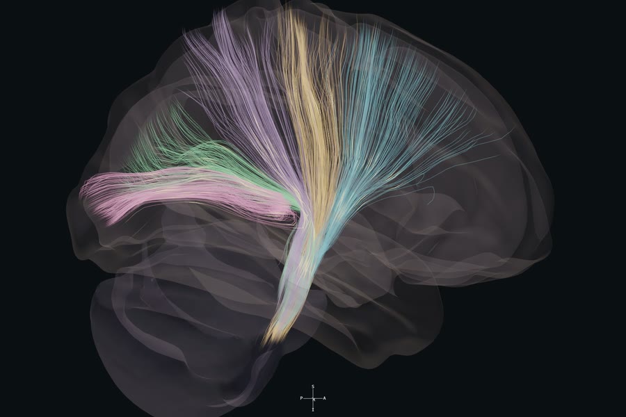 Projection fibres fanning from the brainstem to the cortex in the reference atlas.