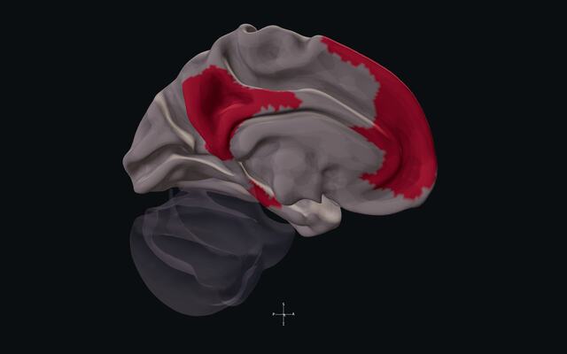 Default mode and memory relationships on the reference brain.
