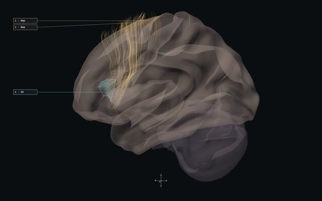 Frontal aslant and medial frontal speech-planning relationships.