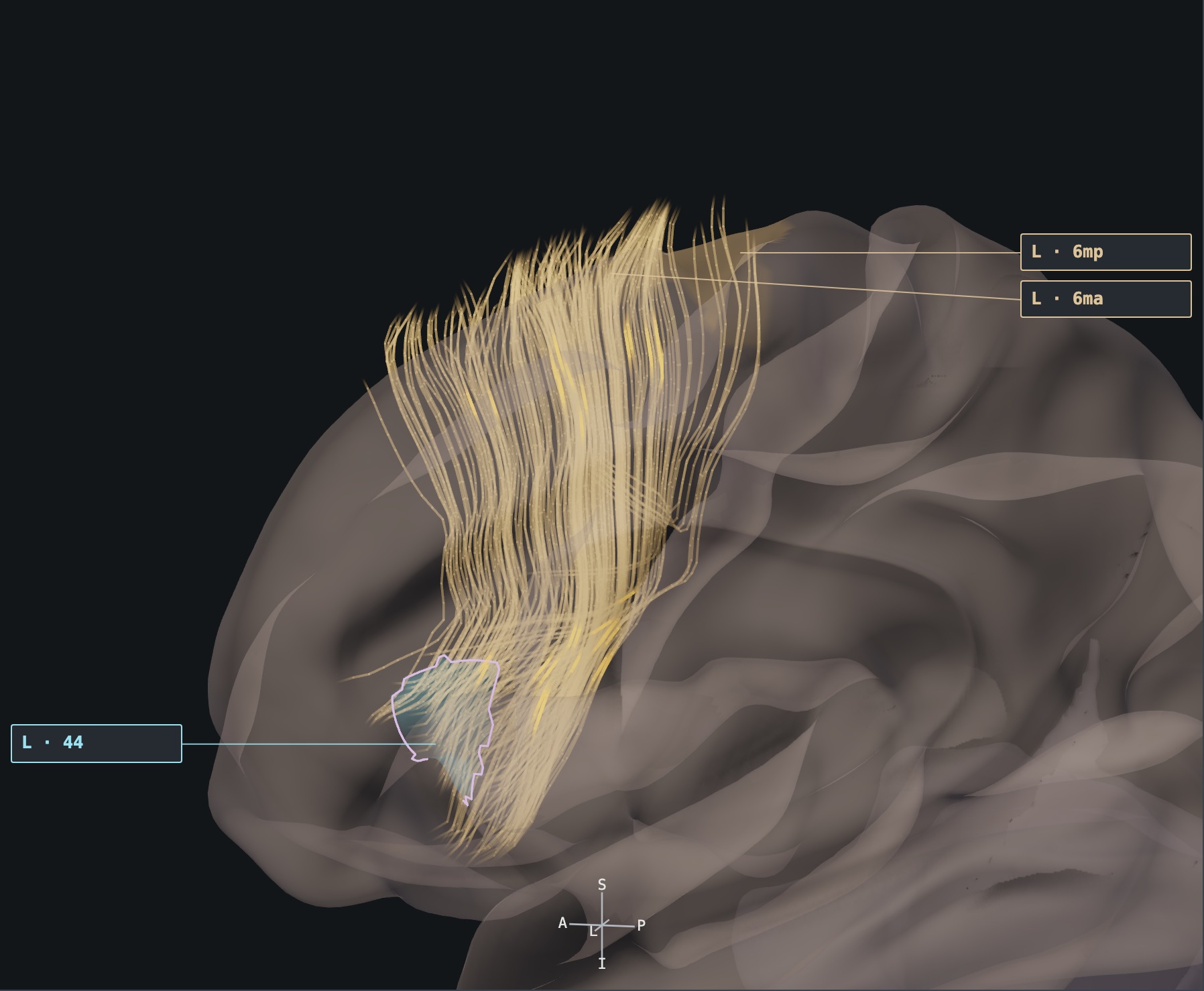 Left frontal aslant tract sample seen through translucent cortex, with atlas parcels 44, 6ma and 6mp labelled.